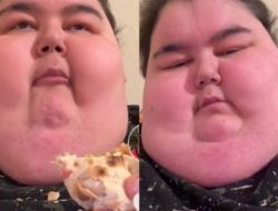 Mukbang Maut, TikToker Populer Meninggal karena Komplikasi Obesitas di Usia Muda