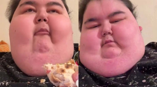 Mukbang Maut, TikToker Populer Meninggal karena Komplikasi Obesitas di Usia Muda