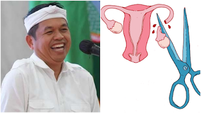 Dedi Mulyadi Mau Jadikan Vasektomi Syarat Terima Bansos, Komnas HAM: Langgar Hak Privasi