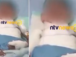 Tragis! Bocah SD di Situbondo Dibakar 4 Temannya Pakai Spiritus, Begini Kronologi dan Kondisi Korban