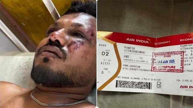 Korban Selamat dari Insiden Jatuhnya Pesawat Air India Duduk di Kursi 11A, Ajaib Luput dari Maut