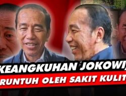 Ya Ampun! Publik Soroti Gestur Jokowi Sembunyikan Tangan Saat Wawancara, Sakit Kulit Makin Parah?