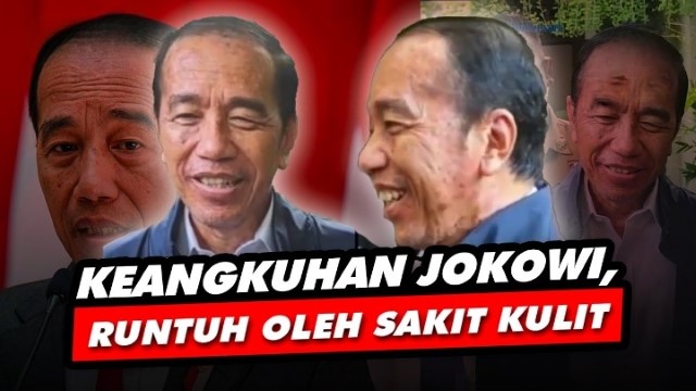 Ya Ampun! Publik Soroti Gestur Jokowi Sembunyikan Tangan Saat Wawancara, Sakit Kulit Makin Parah?