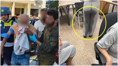 Unggah Foto-Foto Korban Rudal Iran, Israel Tak Dapat Simpati Malah Dibilang Kena Karma atas Gaza