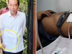 Apa Itu CAPD? Jokowi Disebut Pakai Alat Kesehatan Khusus di Perut saat Ultah ke-64