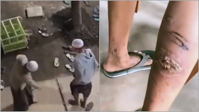 Viral Santri di Malang Dicambuk Rotan oleh Pengurus Ponpes, Kuasa Hukum Ungkap Fakta Ini