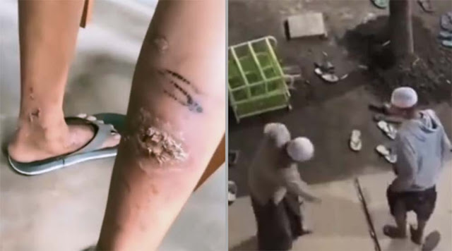 Viral Santri di Malang Dicambuk Rotan oleh Pengurus Ponpes, Kuasa Hukum Ungkap Fakta Mencengangkan