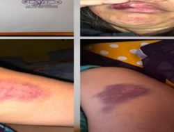 Tak Terima Digerebek Ngamar Bareng Pelakor, Polisi di Sulawesi Utara Hajar Istri