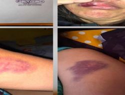 Tak Terima Digerebek Saat Selingkuh, Polisi di Sulawesi Utara Hajar Istri