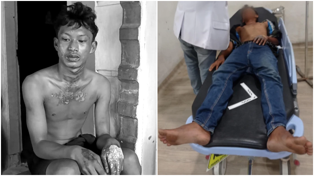 Tragis! Remaja Dibakar Hidup-hidup Usai Curi Ubi, Oknum Brimob dan ASN Jadi Tersangka