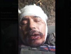Astaga! Kepala Penuh Luka, Begini Kondisi Eks Marinir Satria Kumbara Usai Dihantam Drone Kamikaze