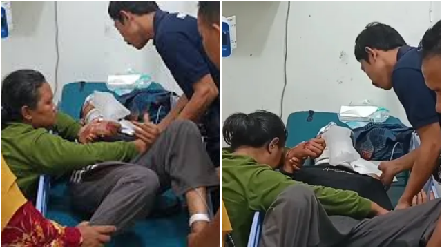 Pelajar SMA Diduga Dianiaya Polisi hingga Tempurung Retak dan Koma