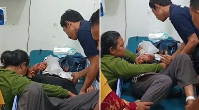 Pelajar Diduga Dianiaya Polisi hingga Tempurung Retak dan Koma, Begini Kronologi Versi Polda Banten