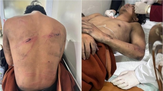 BRUTAL! Pria Ini Jadi Korban Salah Sasaran Polisi Saat Demo Bandung: Niat Cuman Lewat, Malah Digebuk
