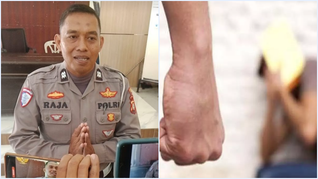 Miris, Oknum Polisi Biarkan Putranya Pukuli Guru di Hadapan Dia, Perkara Dilapor ke BK Suka Bolos