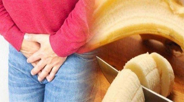 WANITA Potong Kelamin Pacarnya Setelah Ngaku Sudah Punya Istri di Kampung, Korban Alami Kritis
