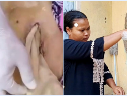 Lansia di Bekasi Meninggal usai Operasi Bisul, Perut Terisi Kasa Tanpa Dijahit, RS Klaim Sesuai SOP